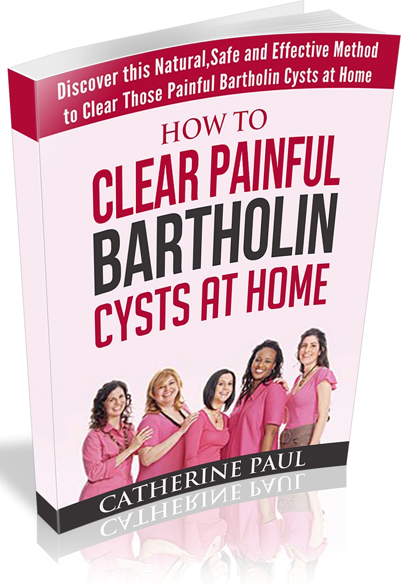 Bartholin Cysts No More